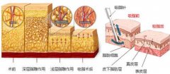 上海做吸脂減肥會對身體有危險嗎