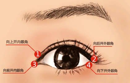 石家莊開(kāi)眼角恢復(fù)時(shí)間內(nèi)可帶眼鏡嗎