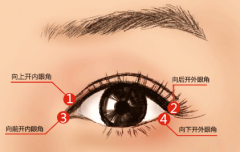 石家莊開眼角恢復時間內(nèi)可帶眼鏡嗎