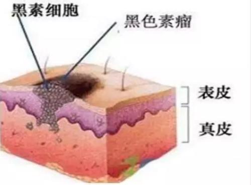 激光祛斑價(jià)格