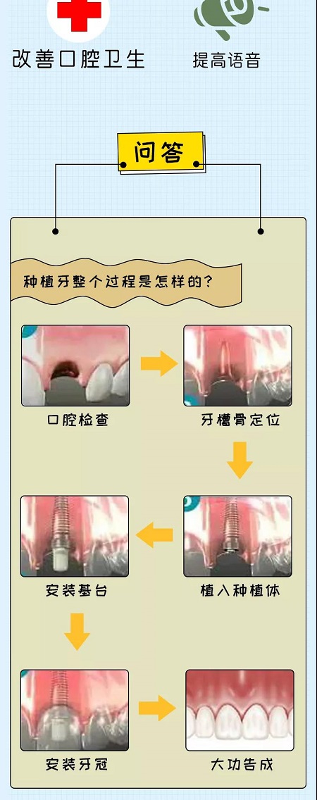 牙齒矯正可以用一輩子嗎？