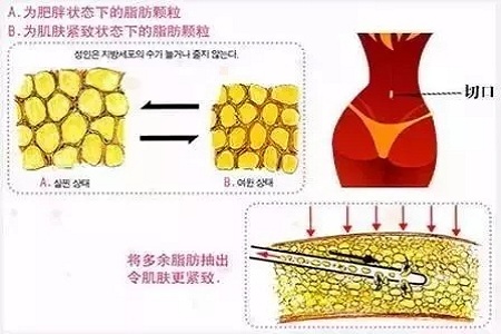 四月不吸脂，五、六、七月徒傷悲......