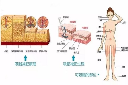 四月不吸脂，五、六、七月徒傷悲......