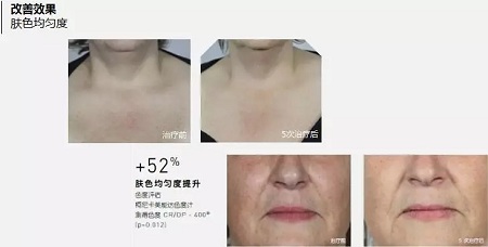 抗衰老的“水光”究竟為何飽受稱贊？