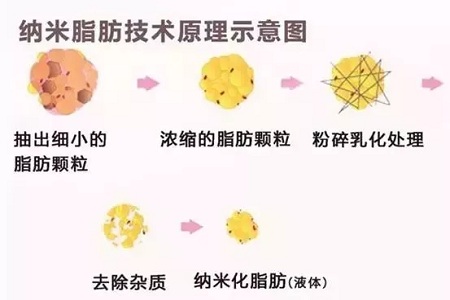 拿什么拯救你，我的黑眼圈？