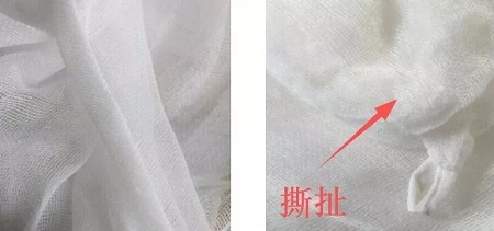 為什么瘦人也會(huì)有“肥胖紋”？