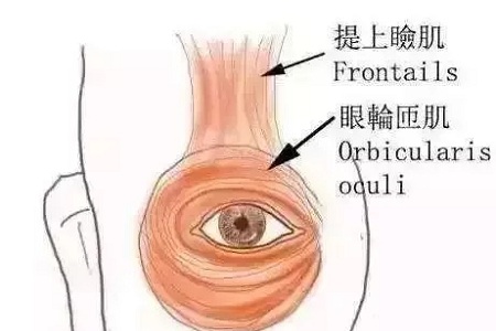 做了雙眼皮，醫(yī)師為什么建議要多睜眼？