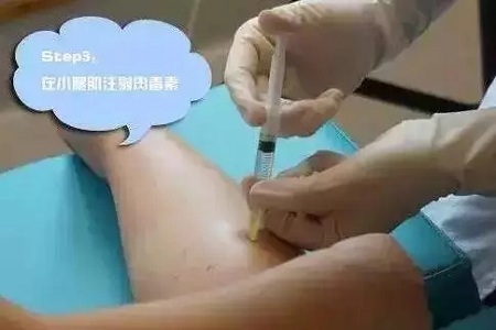 這有一個快速又持久瘦小腿的方法！請注意查收！