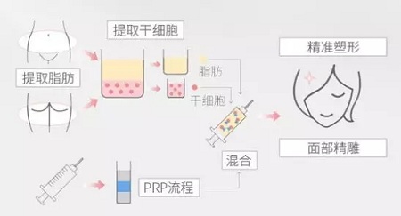 美萊實驗室：瘦臉、ReFa都解決不了你的臉大問題交給我就對了