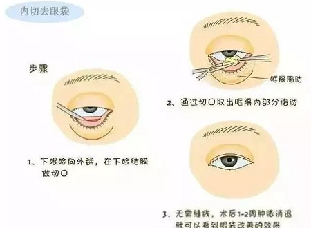 還把眼袋當(dāng)臥蠶？那就別怪小弟弟喊你阿姨了