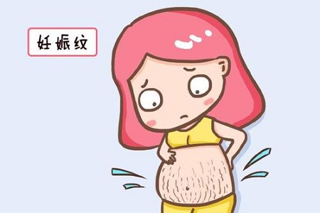 拉皮手術(shù)去妊娠