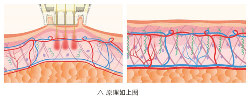 超光子+水光，“撐起”皮膚彈、潤(rùn)、緊